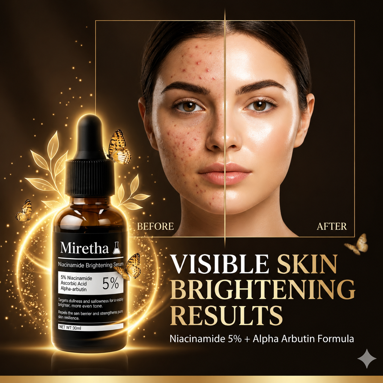 Miretha Niacinamide Brightening Serum | Fade Dark Spots, Acne Marks & Even Skin Tone