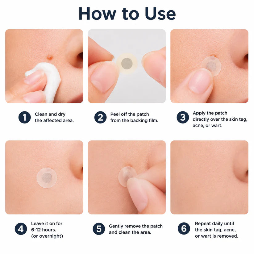 ✨Miretha® 2-in-1 Microneedle &Hydrocolloid Patch
