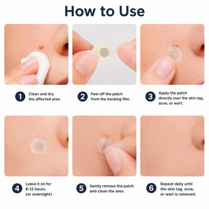 ✨Miretha® 2-in-1 Microneedle &Hydrocolloid Patch