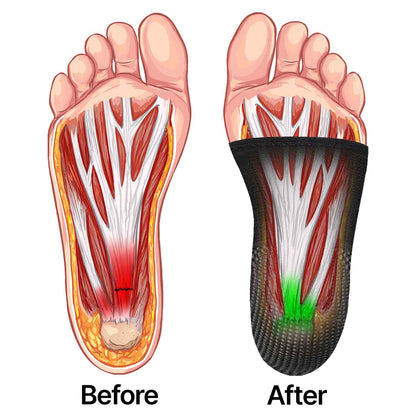 13 Reasons Why TopSpire Sleeves Actually Fix Morning Heel Pain (When Nothing Else Could)
