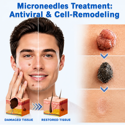 Miretha® 2-in-1 Microneedle & Hydrocolloid Patch👨‍⚕️ | Removes raised moles, acne, flat warts, and skin tags | Helps improve wrinkles, scars, and blemishes | Invisible patches for face and body💖