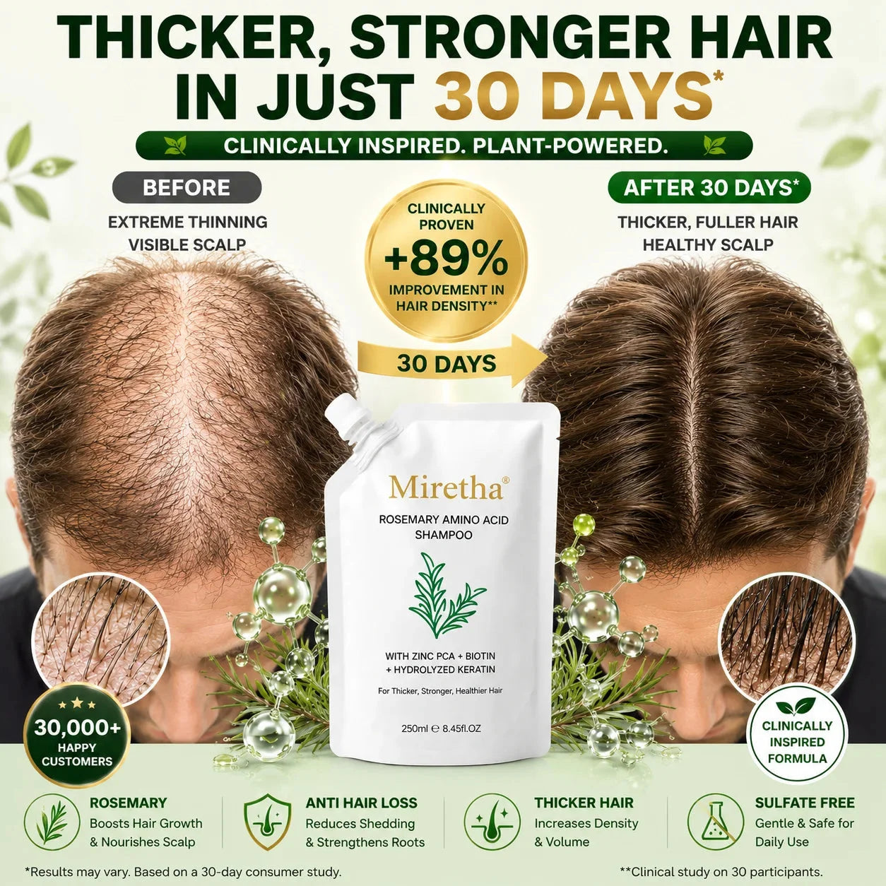 Miretha®Rosemary&Anti-Hair Fall HairLoss Treatment Shampoo