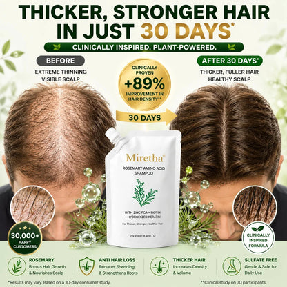 Miretha®Rosemary&Anti-Hair Fall HairLoss Treatment Shampoo