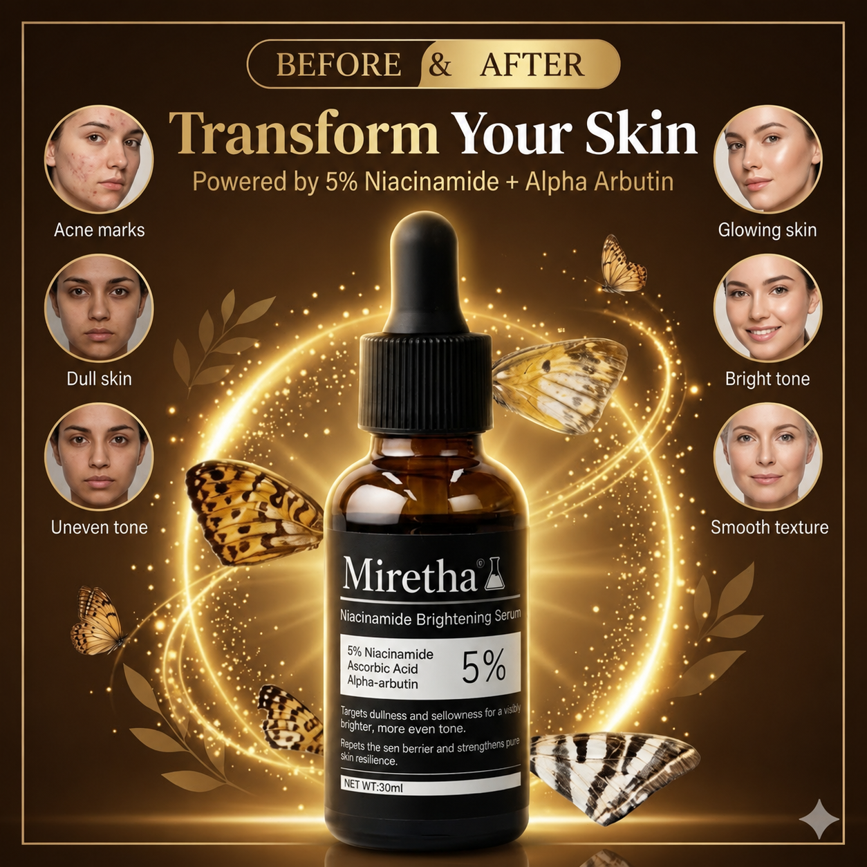 Miretha Niacinamide Brightening Serum | Fade Dark Spots, Acne Marks & Even Skin Tone
