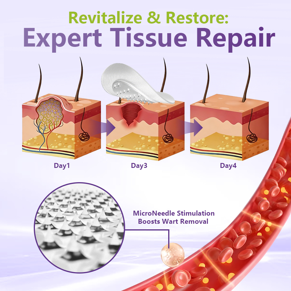 Miretha® Soluble Microneedle Botanical Skin Tag Removal Patch