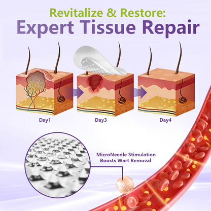 Miretha® Soluble Microneedle Botanical Skin Tag Removal Patch