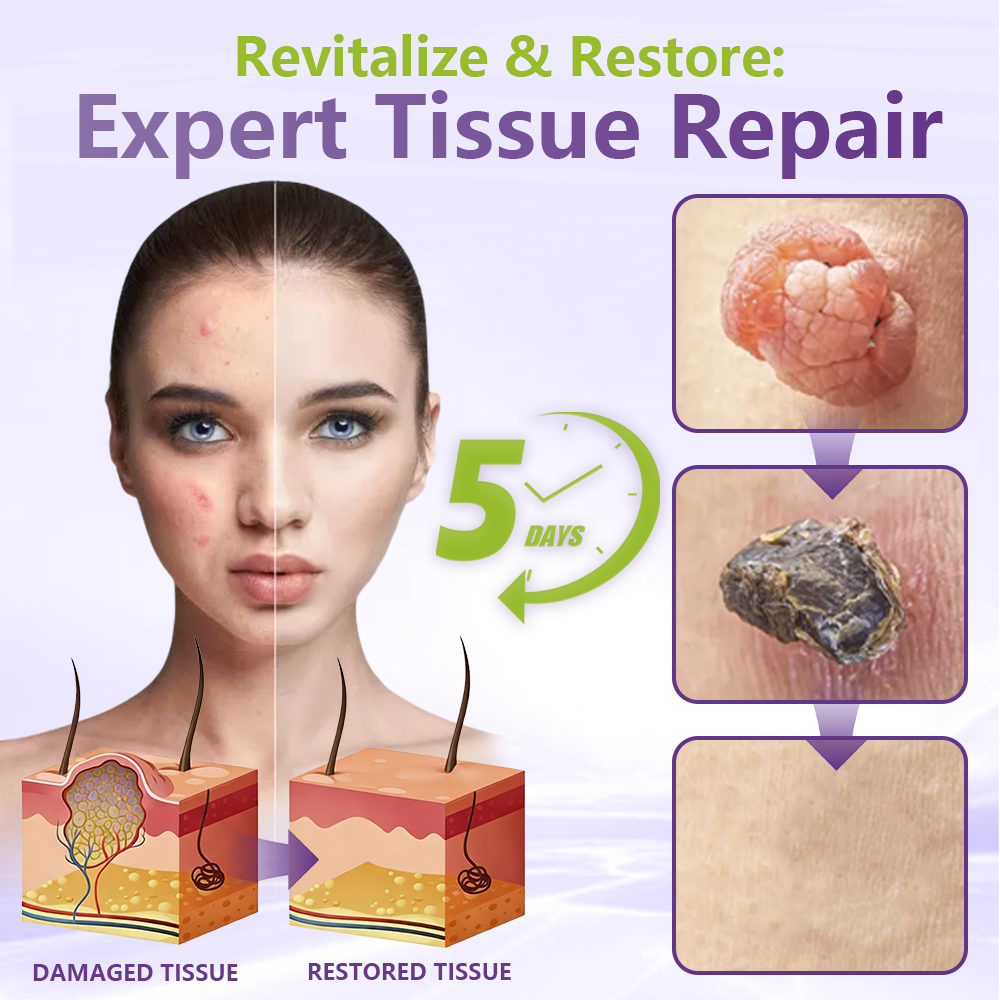 Miretha® Soluble Microneedle Botanical Skin Tag Removal Patch