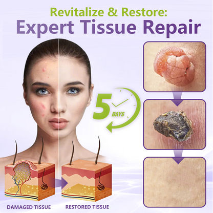 Miretha® Soluble Microneedle Botanical Skin Tag Removal Patch