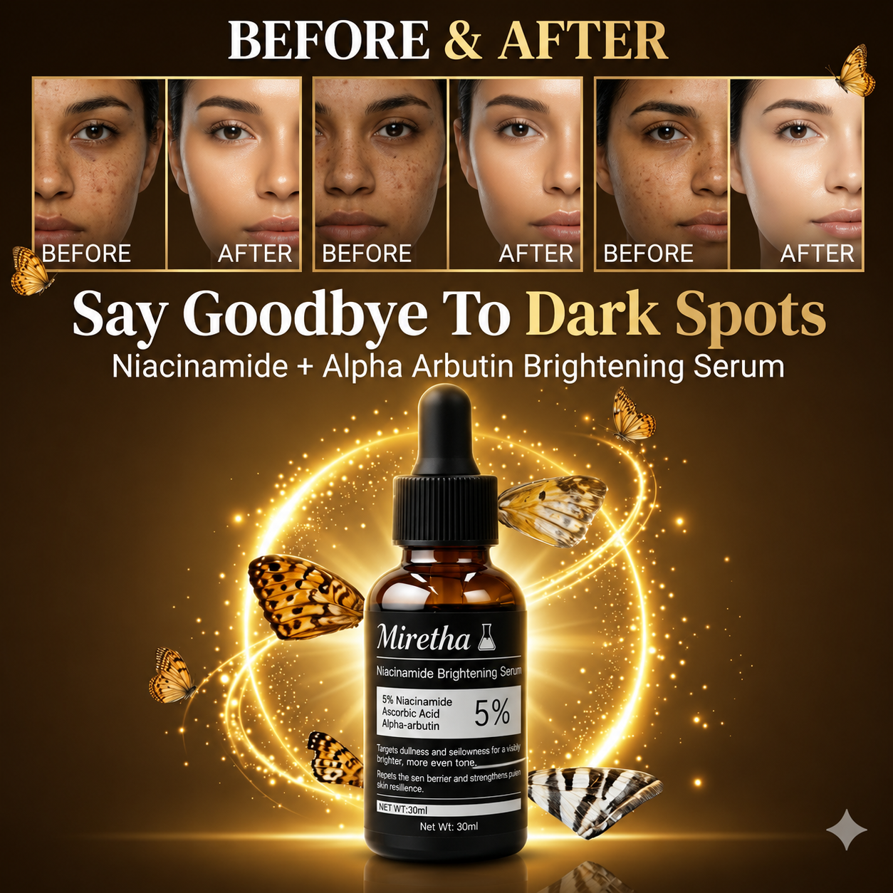 Miretha Niacinamide Brightening Serum | Fade Dark Spots, Acne Marks & Even Skin Tone