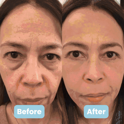 MIRETHA 3-in-1 LED Facial Sculptor