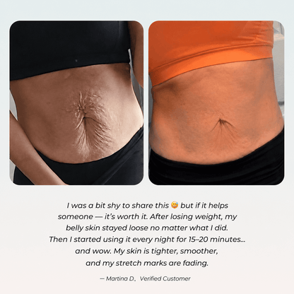 Miretha™ - EMS + Red Light Lymphatic Drainage Sculpting System