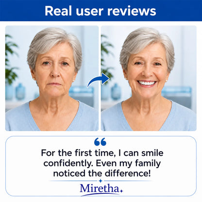 Custom-Fit Dentures for Everyday Comfort