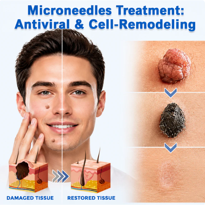 ✨Miretha® 2-in-1 Microneedle &Hydrocolloid Patch