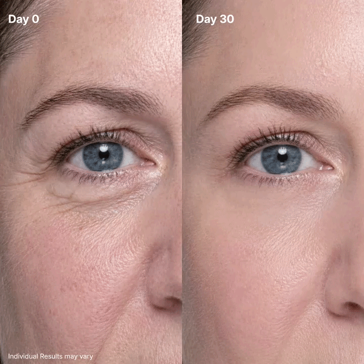 Eye Renewal Crème – 3-in-1 Red Light & Microcurrent Eye Care – Miretha